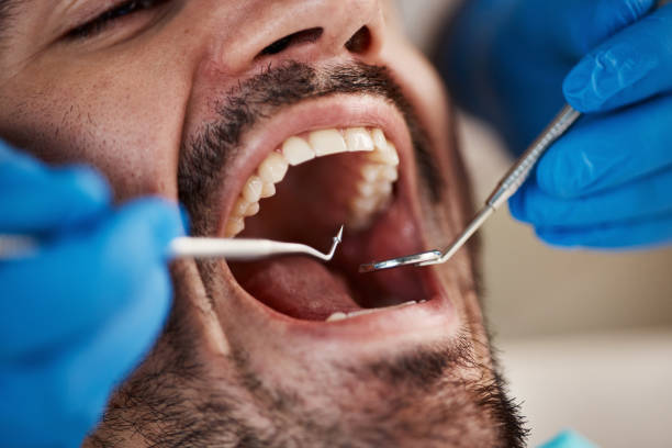 Best Emergency Gum Pain Relief  in Perry, KS