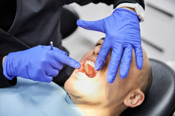 Best Dentist for Tooth Abscess  in Perry, KS